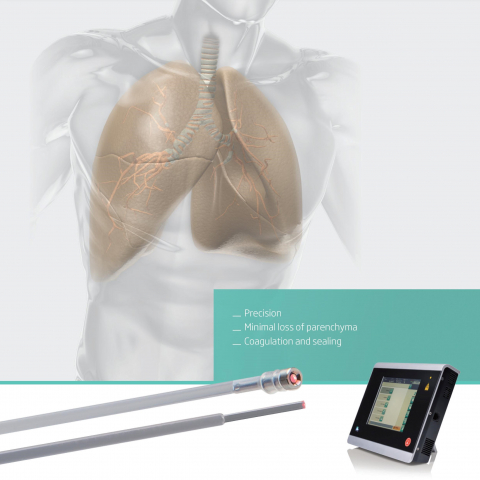  Minimally invasive surgery of lung metastases and bronchial tumors 